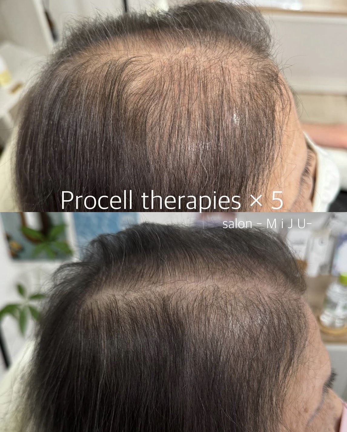 BEFORE・AFTER